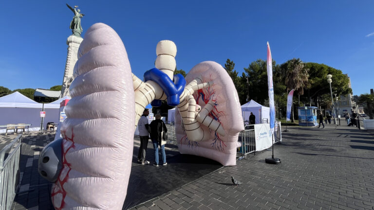 “C’est un moyen de prendre conscience” : à Nice, un poumon gonflable géant pour sensibiliser contre le cancer